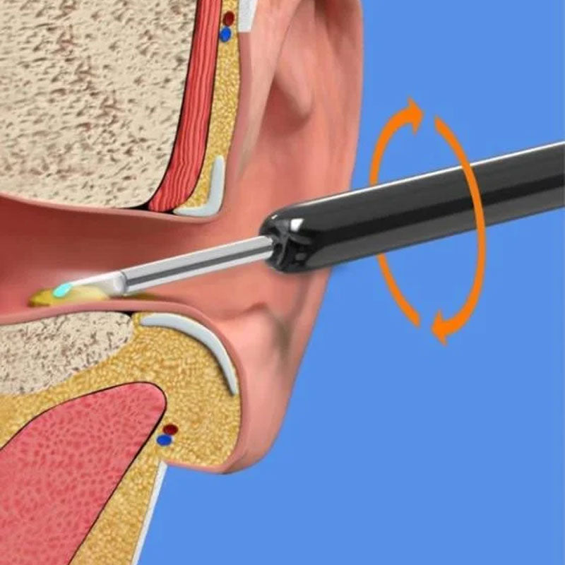 WiFi Version Visual Ear Pick